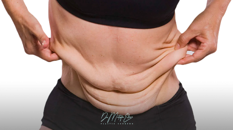 تعرف على خيارات علاج الجلد المترهل الجراحية والطبيعية