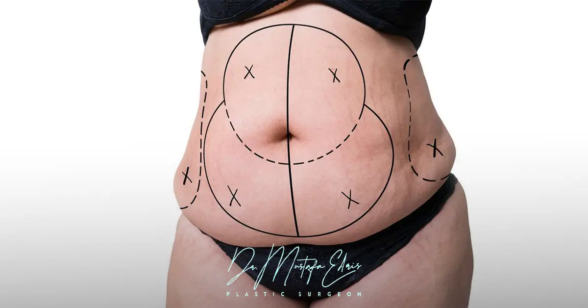 افضل دكتور نحت الجسم في مصر